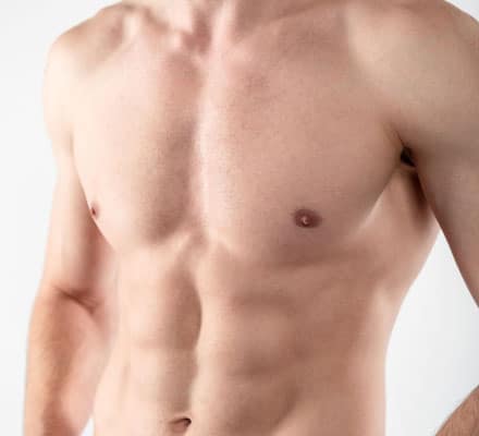 male breast reduction
