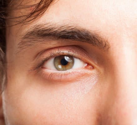 men eyelid surgery